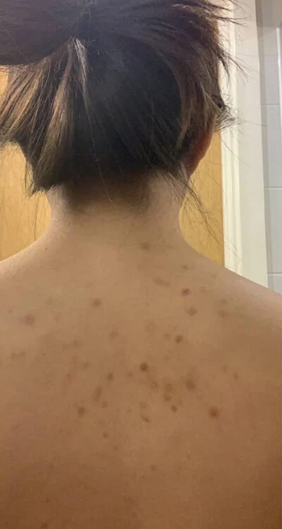 Skóra przed rozpoczęciem regularnej pielęgnacji